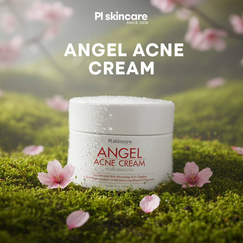 Angel Acne Cream (30gm)