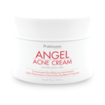 Angel Acne Cream (30gm)